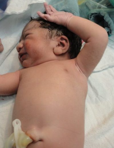 Photographie représentant un bébé à la naissance.